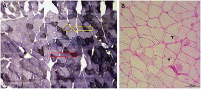 Changes in Musculoskeletal System and Metabolism in Osteoporotic Rats Treated With Urocortin